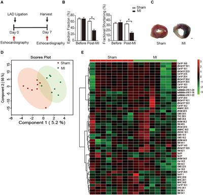 Lipidomics Revealed Alteration of Sphingolipid Metabolism During the Reparative Phase After Myocardial Infarction Injury